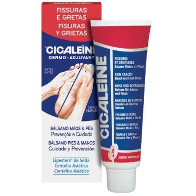 Akileine Cicaleine Fisuras...